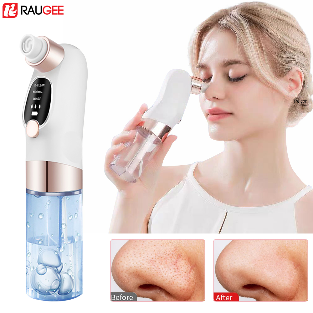 Mitesser Entferner Elektrische – Air Bubble Remover Bewertung und Preis
