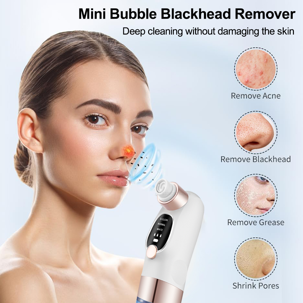 Mitesser Entferner Elektrische – Air Bubble Remover Bewertung und Preis